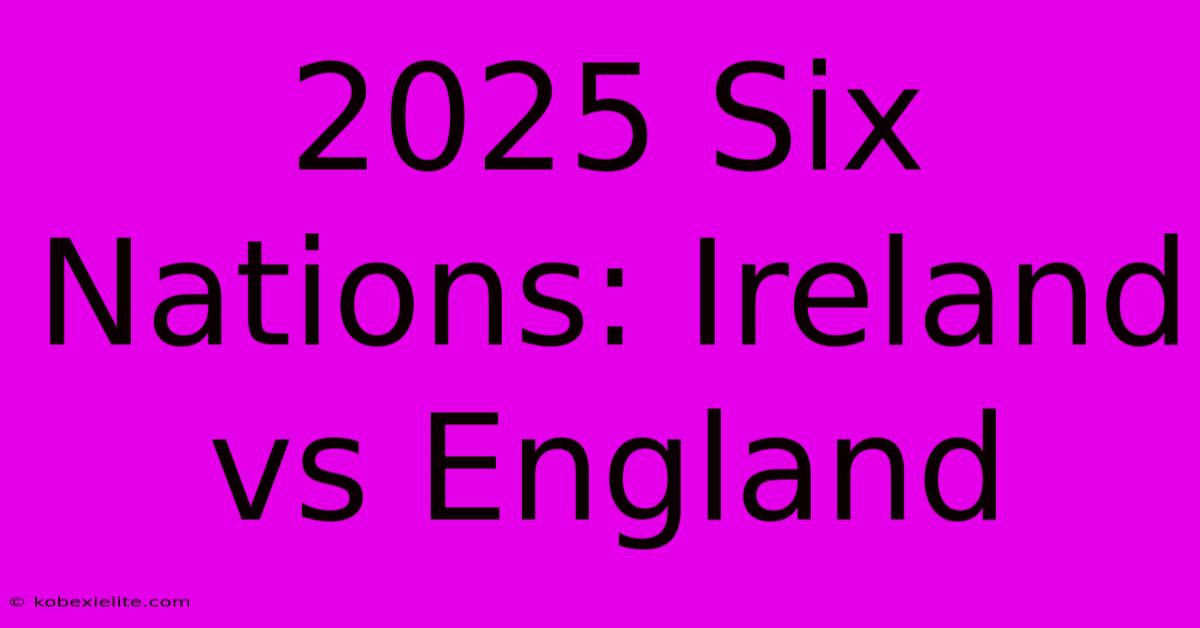 2025 Six Nations: Ireland Vs England