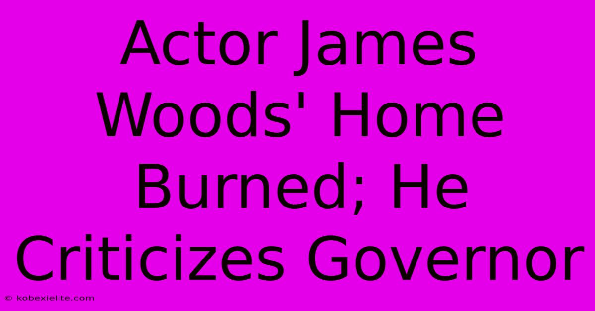 Actor James Woods' Home Burned; He Criticizes Governor