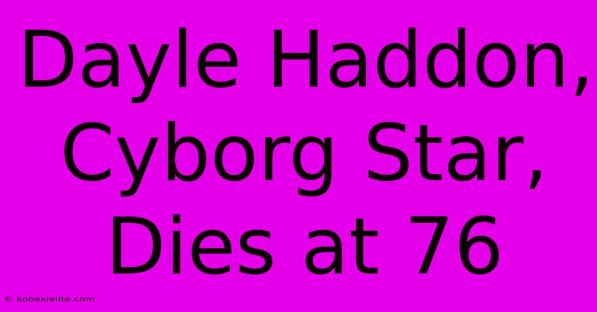 Dayle Haddon, Cyborg Star, Dies At 76