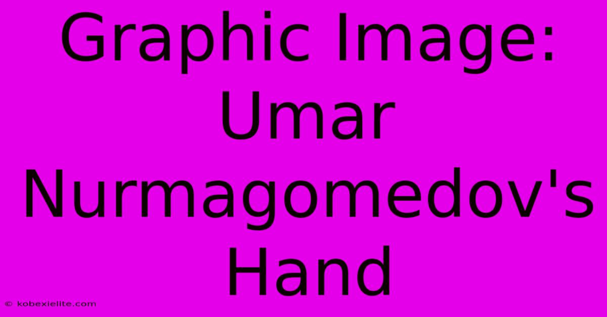 Graphic Image: Umar Nurmagomedov's Hand