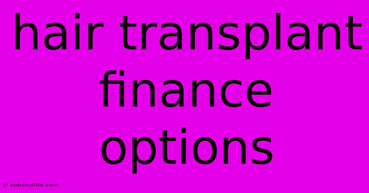 Hair Transplant Finance Options Hair Transplant Finance Options