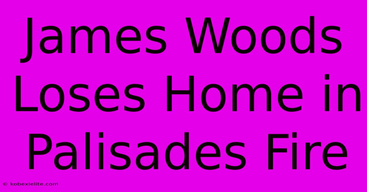 James Woods Loses Home In Palisades Fire