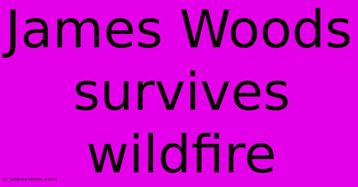 James Woods Survives Wildfire