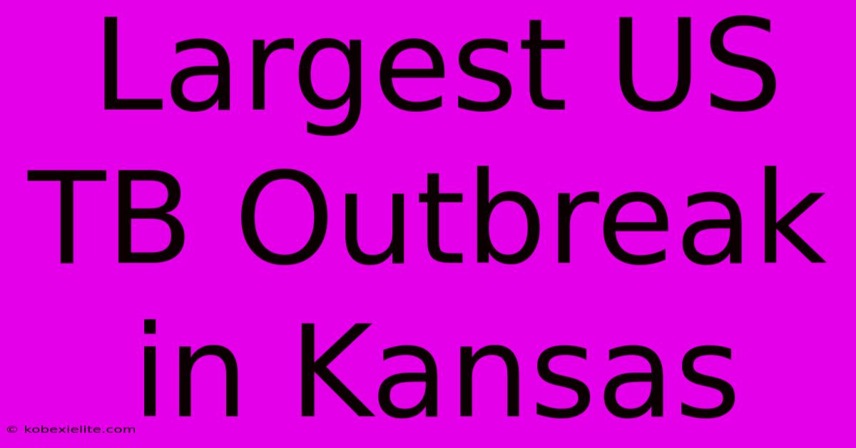 Largest US TB Outbreak In Kansas