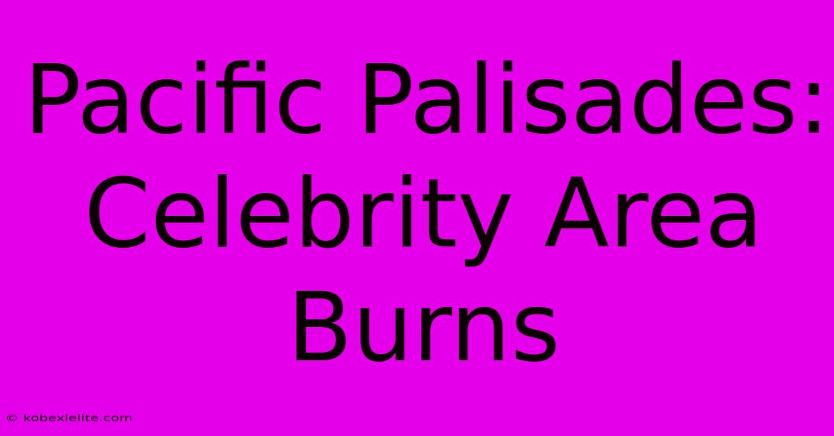 Pacific Palisades:  Celebrity Area Burns