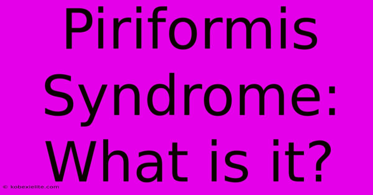 Piriformis Syndrome: What Is It?