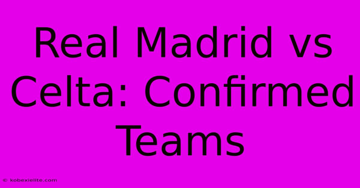 Real Madrid Vs Celta: Confirmed Teams