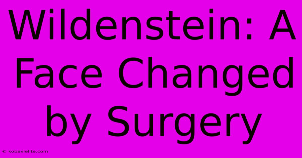 Wildenstein: A Face Changed By Surgery